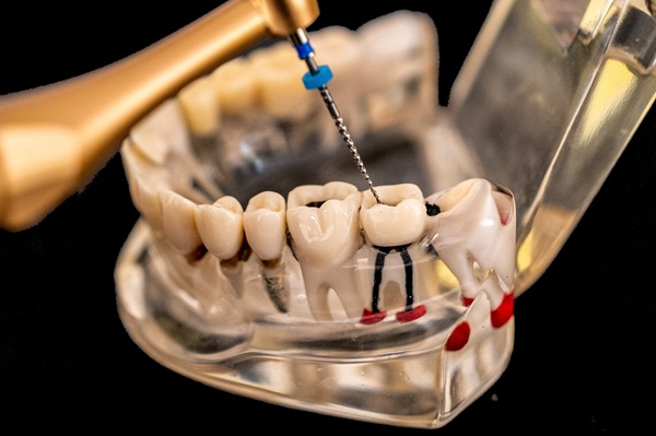 Endodontics Prometric Exam Syllabus: DHA, SCFHS, and Qatar