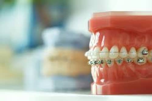 Orthodontics Prometric MCQs